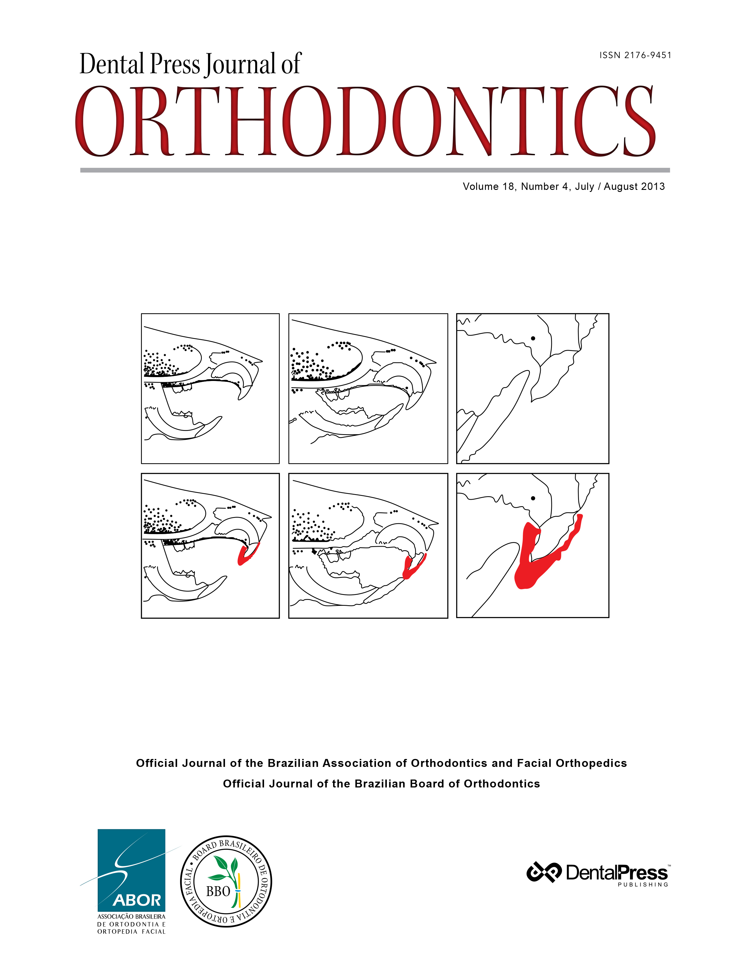 Dental Press Journal of Orthodontics - v. 18, no. 4