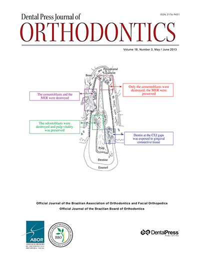 Dental Press Journal of Orthodontics - v. 18, no. 3