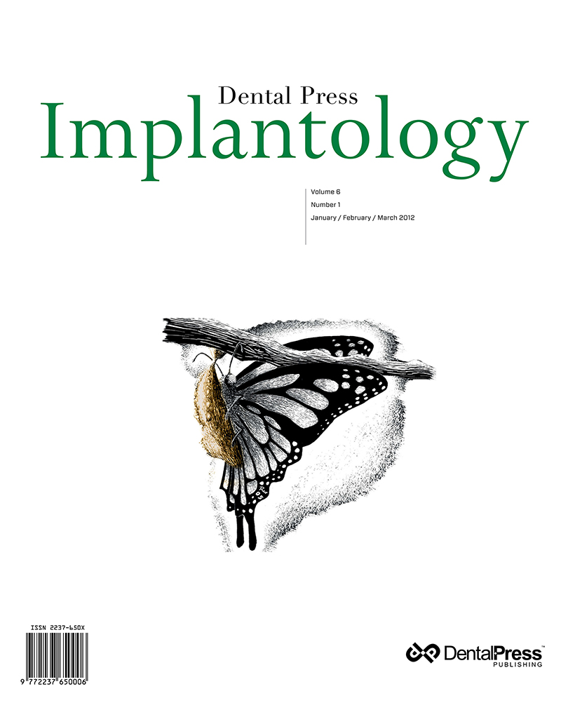 Dental Press Implantology - v. 06, no. 1