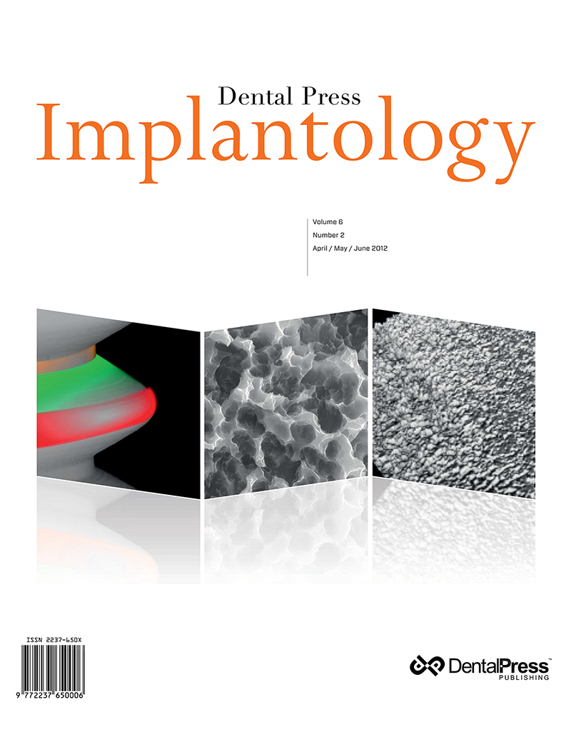 Dental Press Implantology - v. 06, no. 2