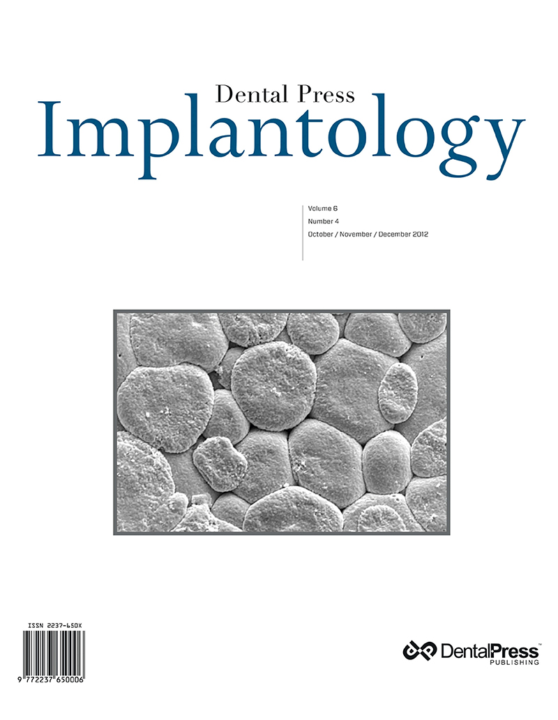 Dental Press Implantology - v. 06, no. 4