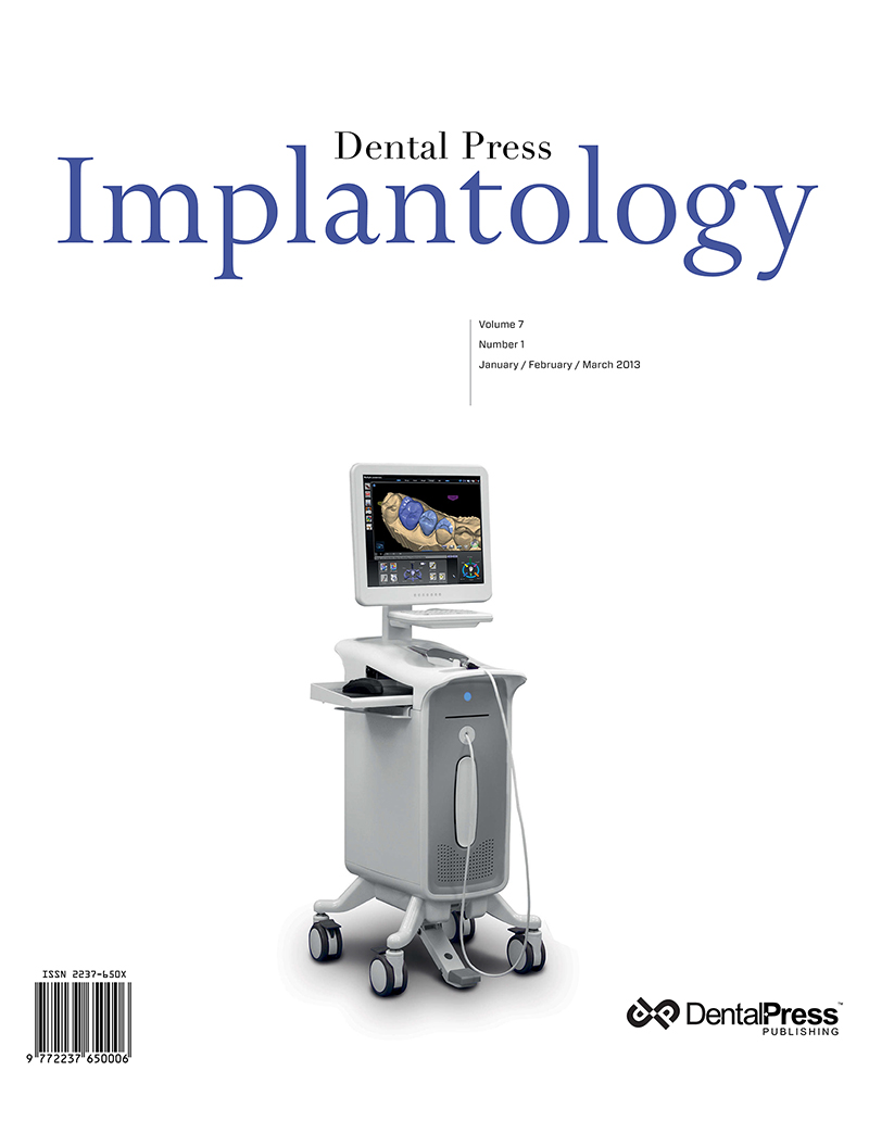Dental Press Implantology - v. 07, no. 1