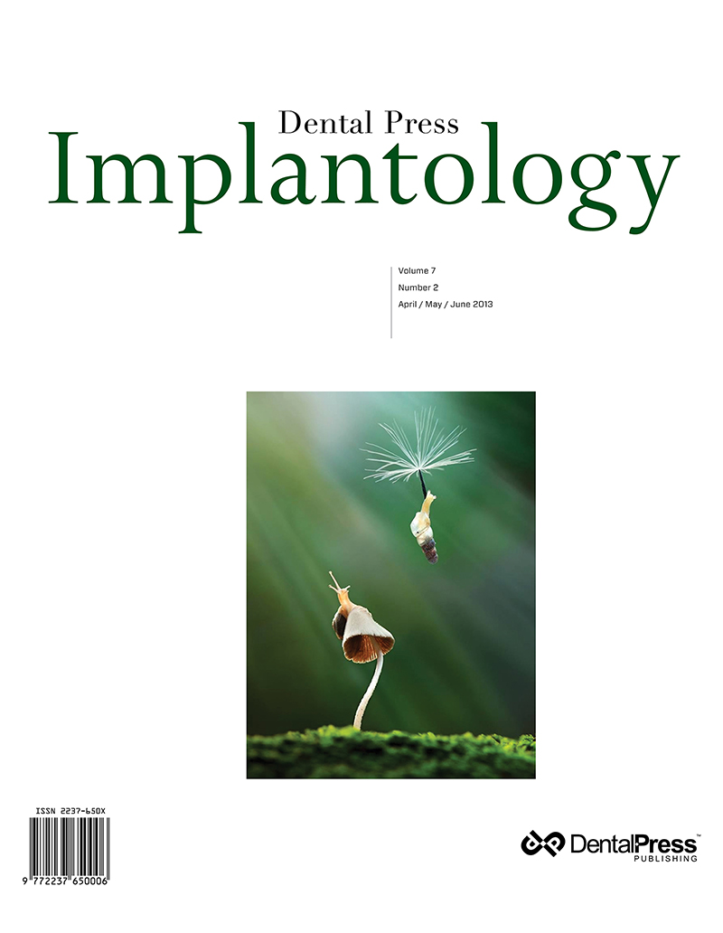 Dental Press Implantology - v. 07, no. 2