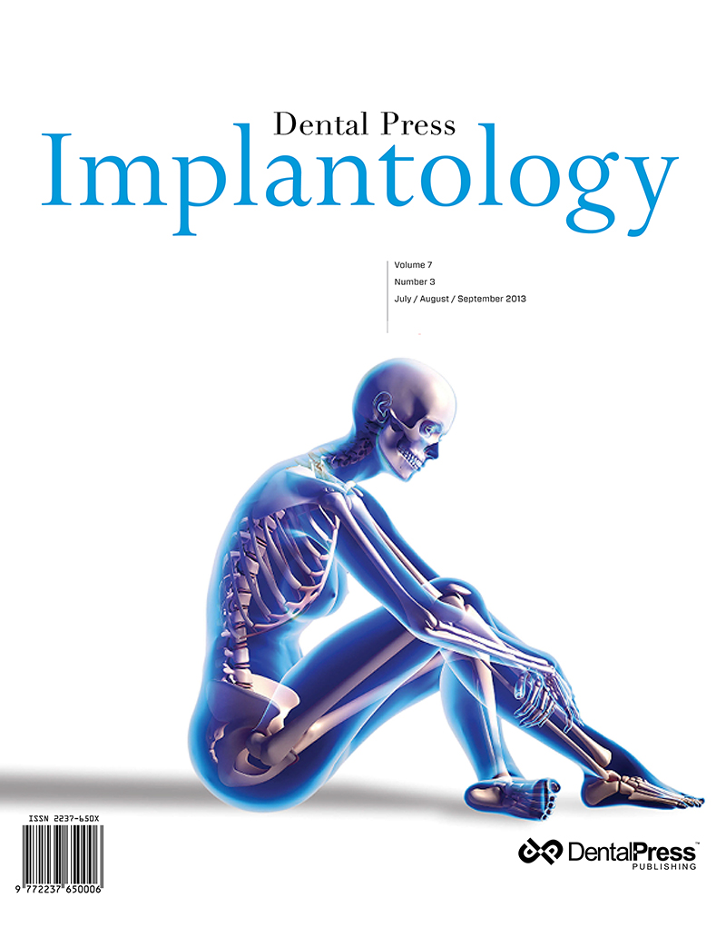 Dental Press Implantology - v. 07, no. 3