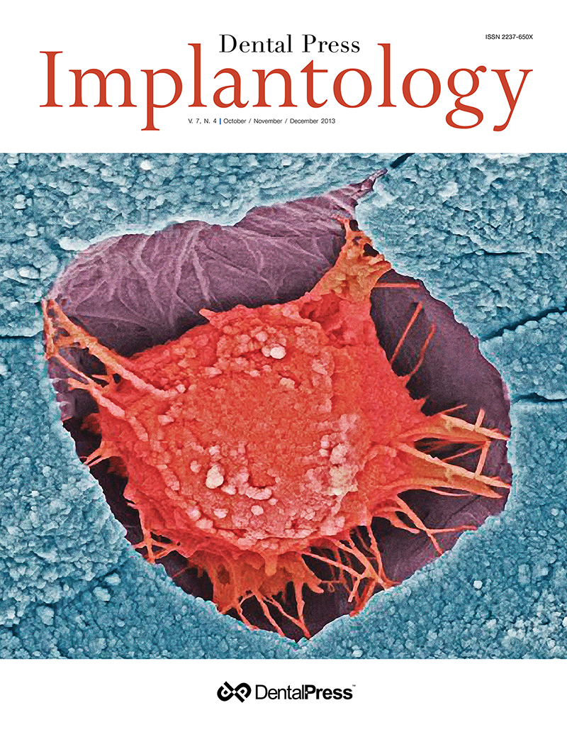 Dental Press Implantology - v. 07, no. 4