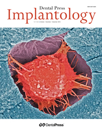 Dental Press Implantology - v. 07, no. 4